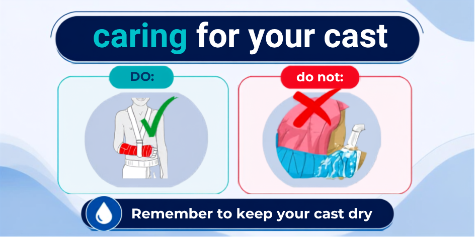 Caring for your Cast