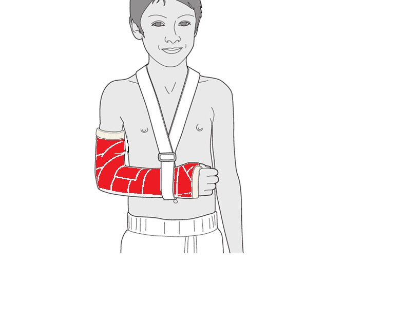 Waterproof Cast Cover for Adult Arm - Size 3 (AA3)