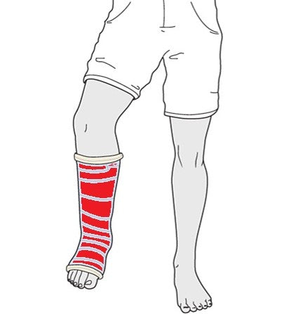Waterproof Cast Cover for Adult Leg - Size 1 (AL1)