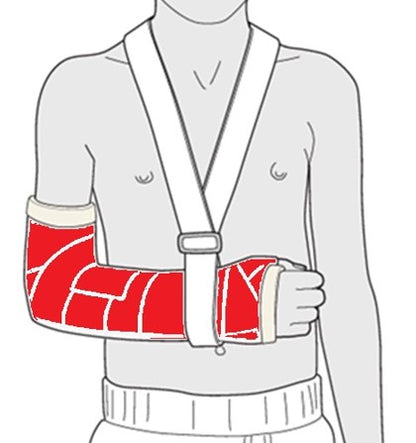 Adult Arm - Size 2 (AA2)